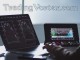 Position Trading vs Investing: Which One is Right for You? Position Trading vs Investing: Which One is Right for You